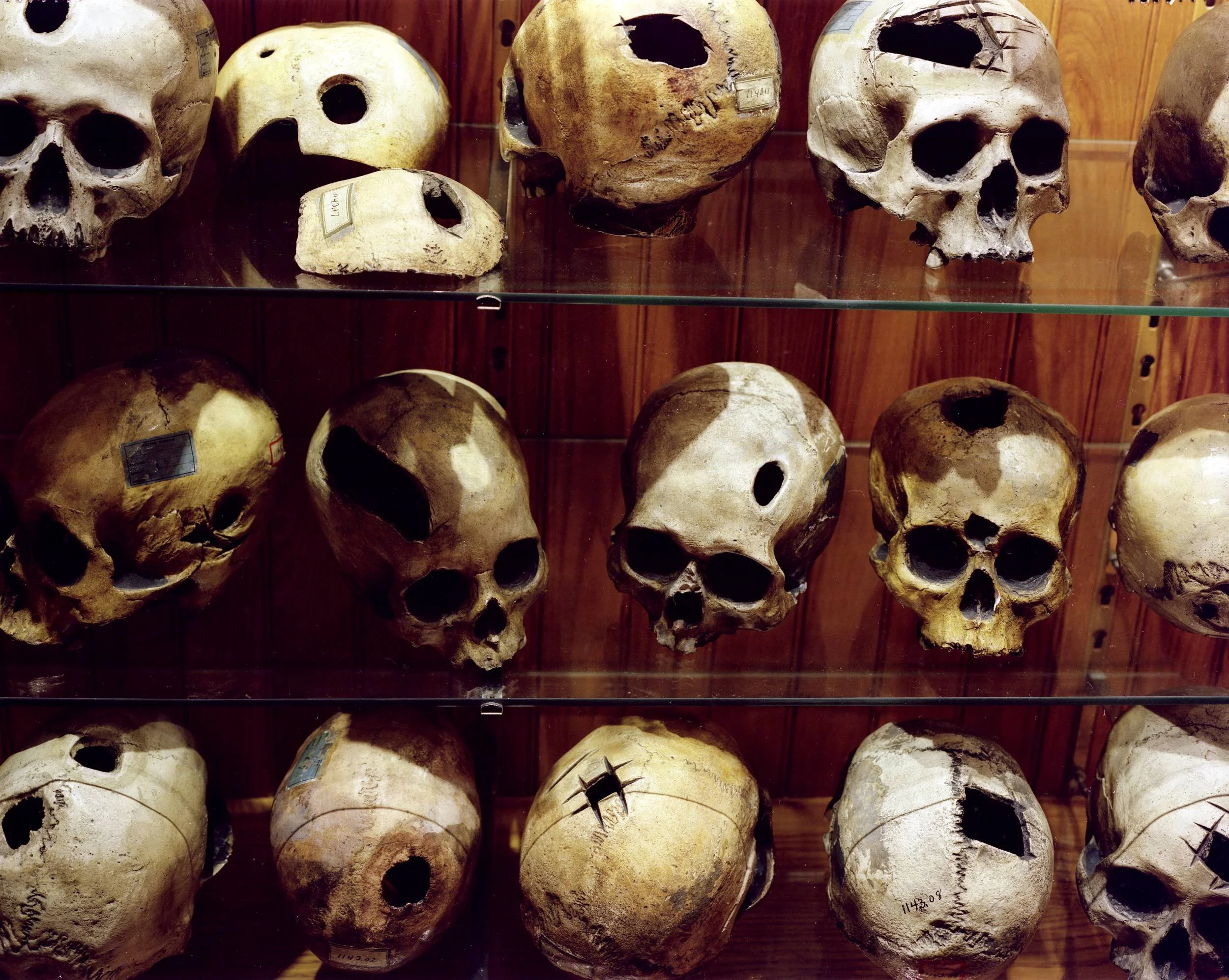 Mutter Museum Fine Art Print No. 1 by Lisa Kereszi — Morbid